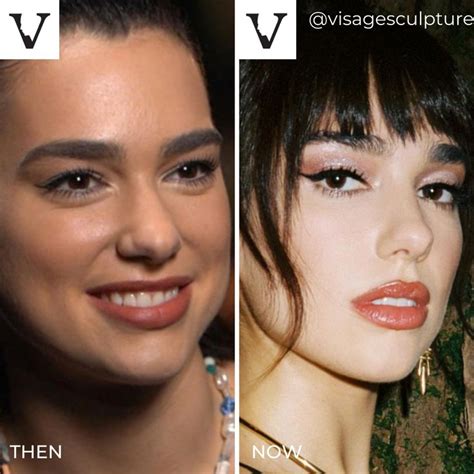 dua lipa collage|dua lipa then and now.